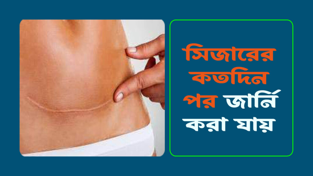 সিজারের কতদিন পর জার্নি করা যায় 1024x576