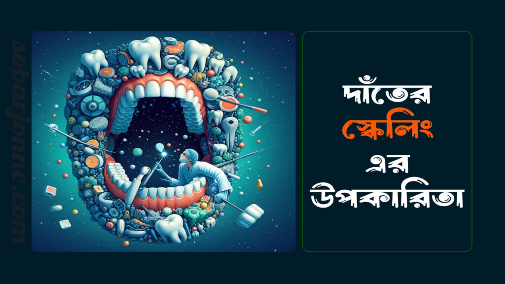 দাঁতের স্কেলিং এর উপকারিতা 0 1024x576