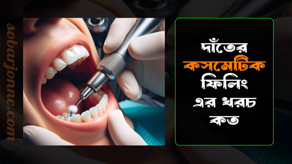 দাঁতের কসমেটিক ফিলিং এর খরচ এবং দাঁতের লেজার ফিলিং খরচ কত দাঁতের কসমেটিক ফিলিং এর খরচ 0 1024x576